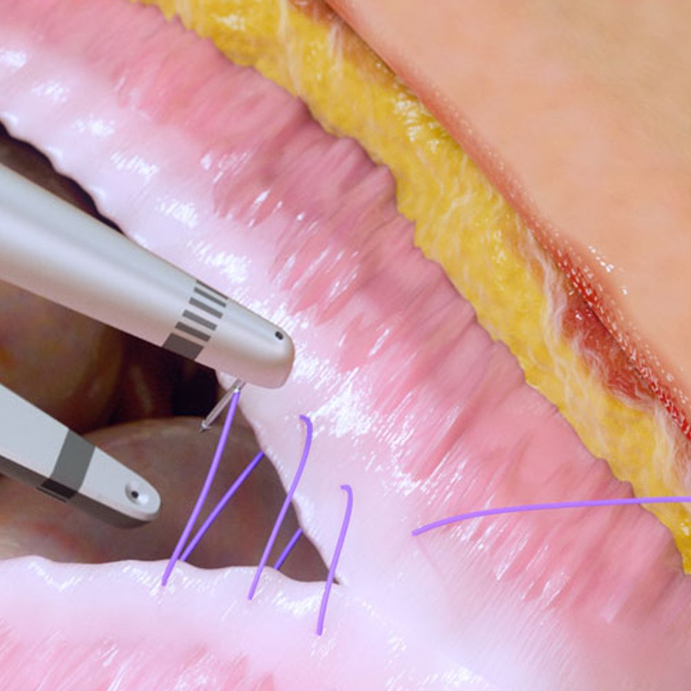 Content-news-Mellon-Medical-Eurostars-Demcon-2